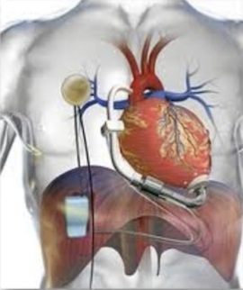 Wireless charging heart pump