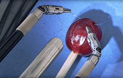 MedTech Robot Stitches up a Grape